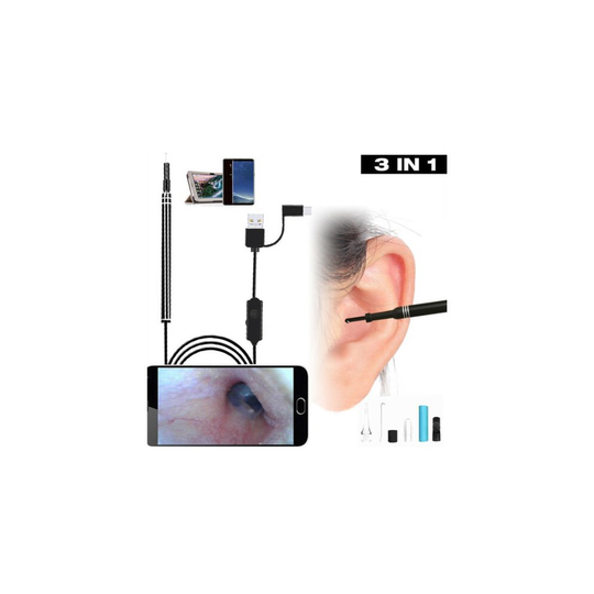Digital Led Otoscope Ear Camera Scope Earwax Removal Kit Ear Wax Cleaning ToolVQ