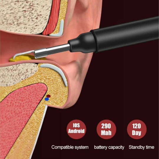 Ear Wax Remover Camera Wireless Endoscope Spoon Cleaning Otoscope 360°Wide Angle